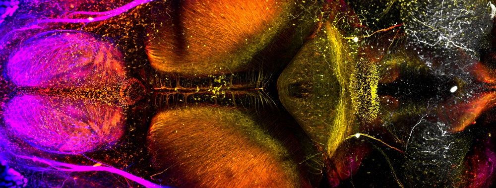 A zebrafish brain. Photo: Nathalie-Jurisch-Yaksi / NTNU